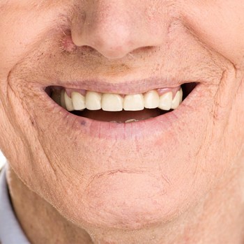 higiene-protesis-dentales2